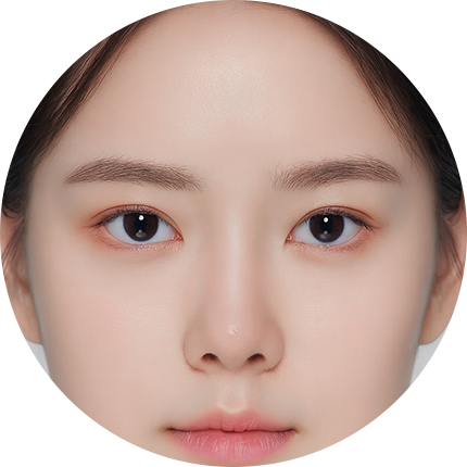 이마거상 실리프팅 후