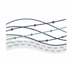 맞춤 리프팅 설계