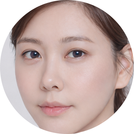 얼굴 전체 리프팅 후